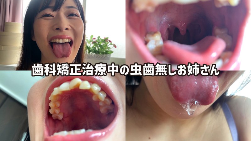 街角で声をかけて口内観察させてもらう ファーストフード店パート みおりさん