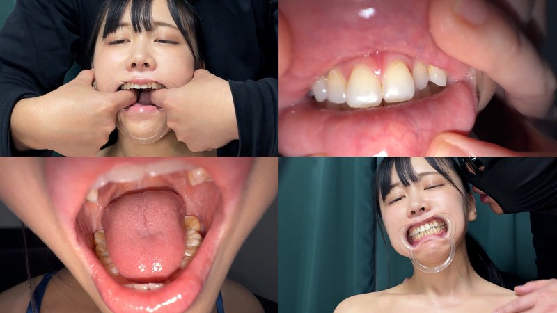 よだれダラダラすずちゃんの口内観察 パッケージ画像