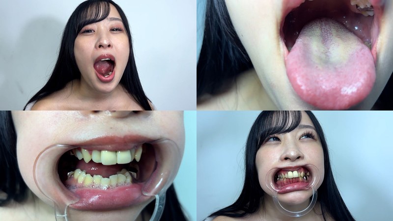 喉ちんこが可愛いゆのちゃんの口内観察 パッケージ画像