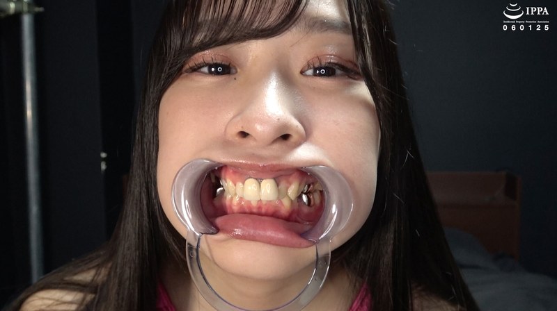 【歯＆口腔】人気女優 朝比ゆのチャンの歯＆口腔＆のどちんこ観察と小魚舐め！ パッケージ画像