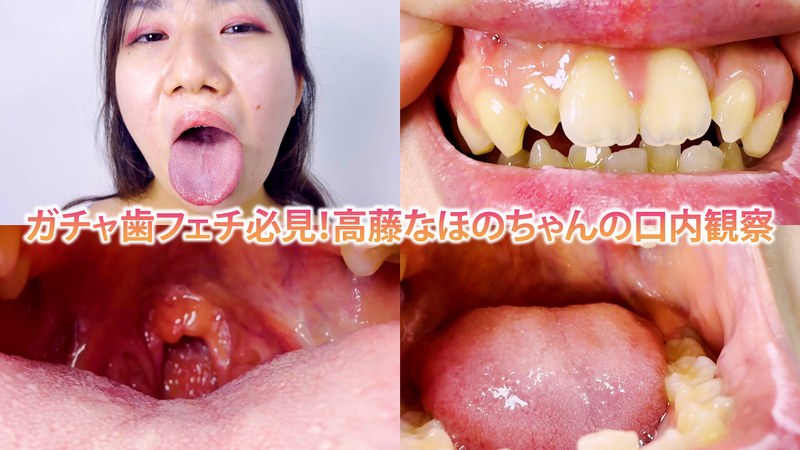 ガチャ歯フェチ必見!高藤なほのちゃんの口内観察 パッケージ画像