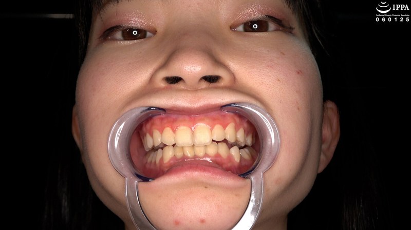 【歯・口腔】ドM女子の激レアな口内・歯・のどちんこ観察★ 伊織ひなの パッケージ画像