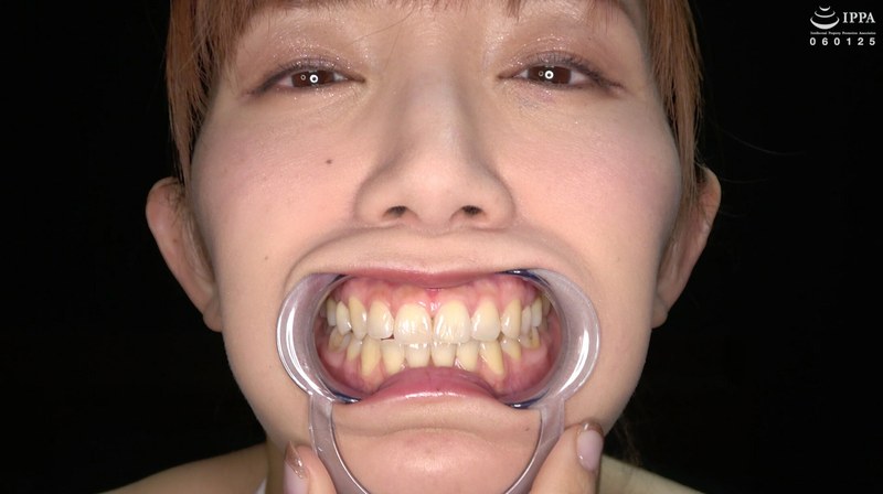 【歯・口内フェチ】綺麗なお姉さんの激レアな治療跡がある歯・口内・のどちんこ観察！ 美泉咲 パッケージ画像