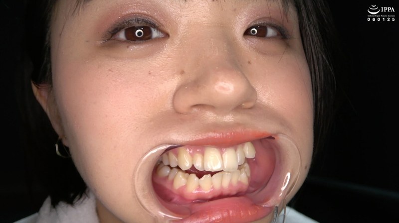 「激カワ人気女優の口内・歯・舌ベロ・のどちんこ観察!!! 菊池はる パッケージ画像