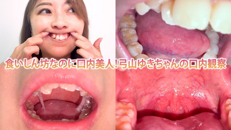 食いしん坊なのに口内美人!弓山ゆきちゃんの口内観察 パッケージ画像